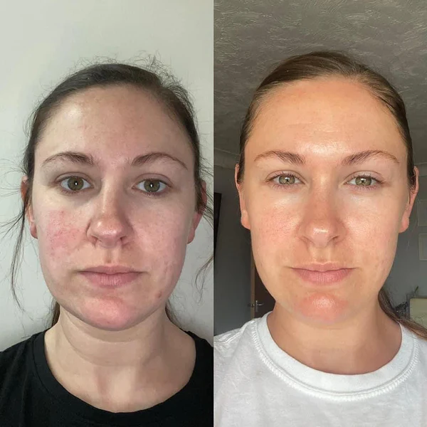 Nolenna™ Maschera al Bio-Collagene