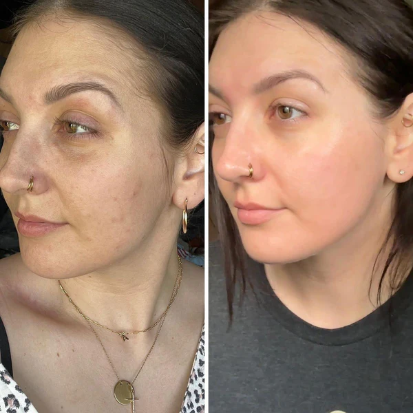 Nolenna™ Maschera al Bio-Collagene