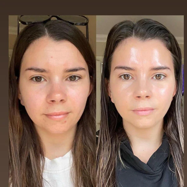 Nolenna™ Maschera al Bio-Collagene