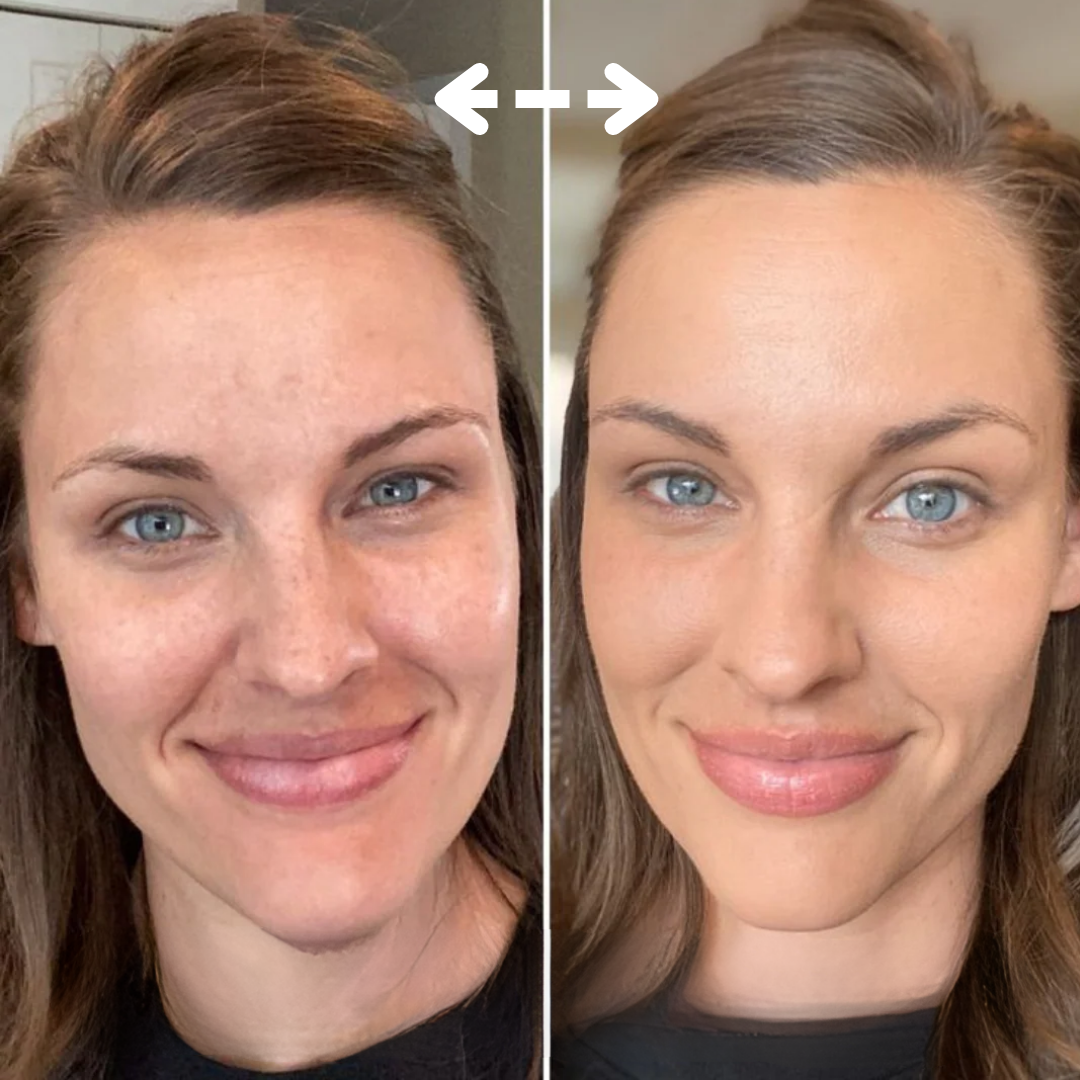 Nolenna™ Maschera al Bio-Collagene