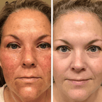 Bio - Collagen Face Mask (By Nolenna) - NOLENNA