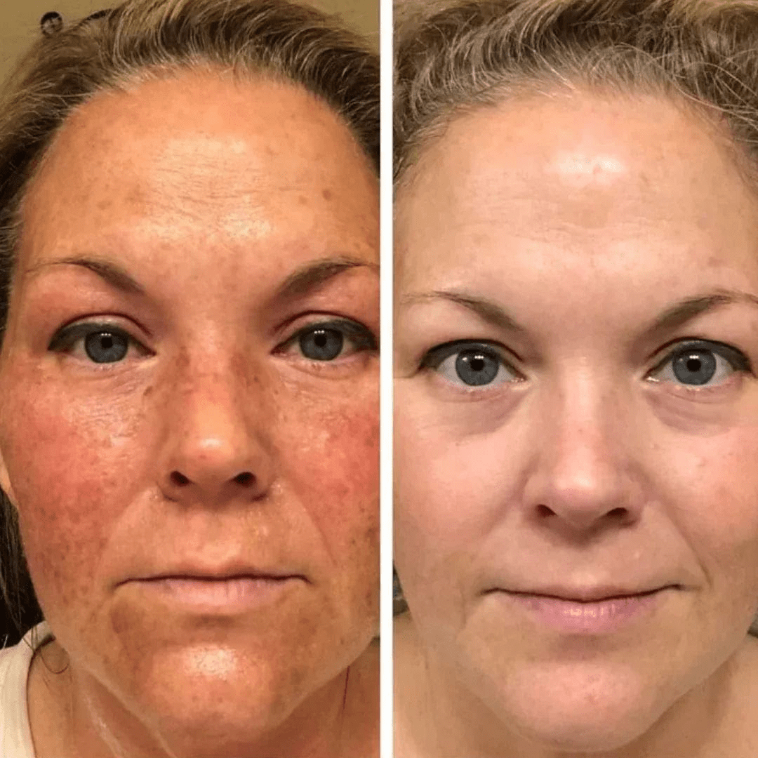 Bio - Collagen Face Mask (By Nolenna) - NOLENNA