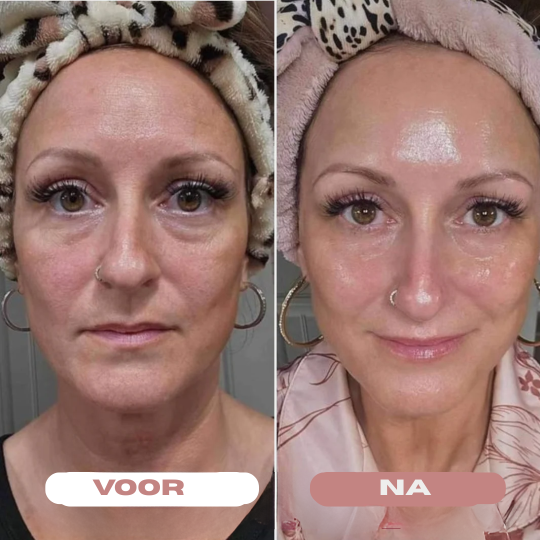 Bio-Collageen Gezichtsmasker - Nolenna™