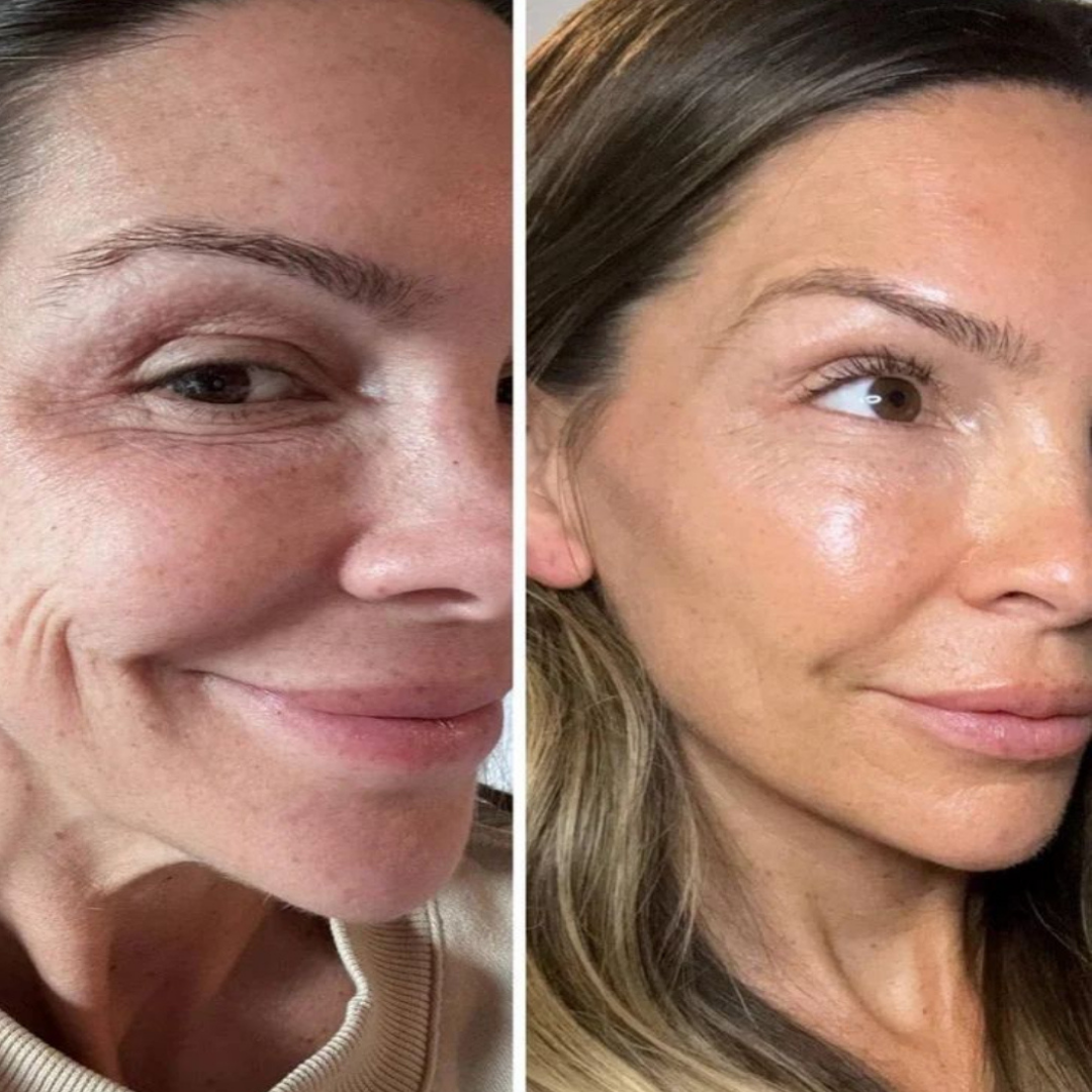Nolenna™ Maschera al Bio-Collagene