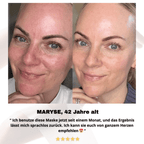 Nolenna™ Bio - Kollagen Gesichtsmaske - NOLENNA